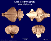 Whole brain image