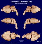 Whole brain image