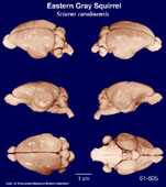 Whole brain image