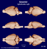 Whole brain image