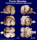 Whole brain image